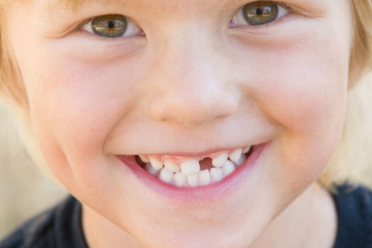 What are dental space maintainers?