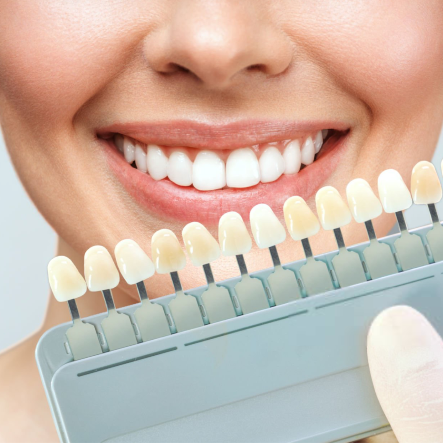 Dental whitening