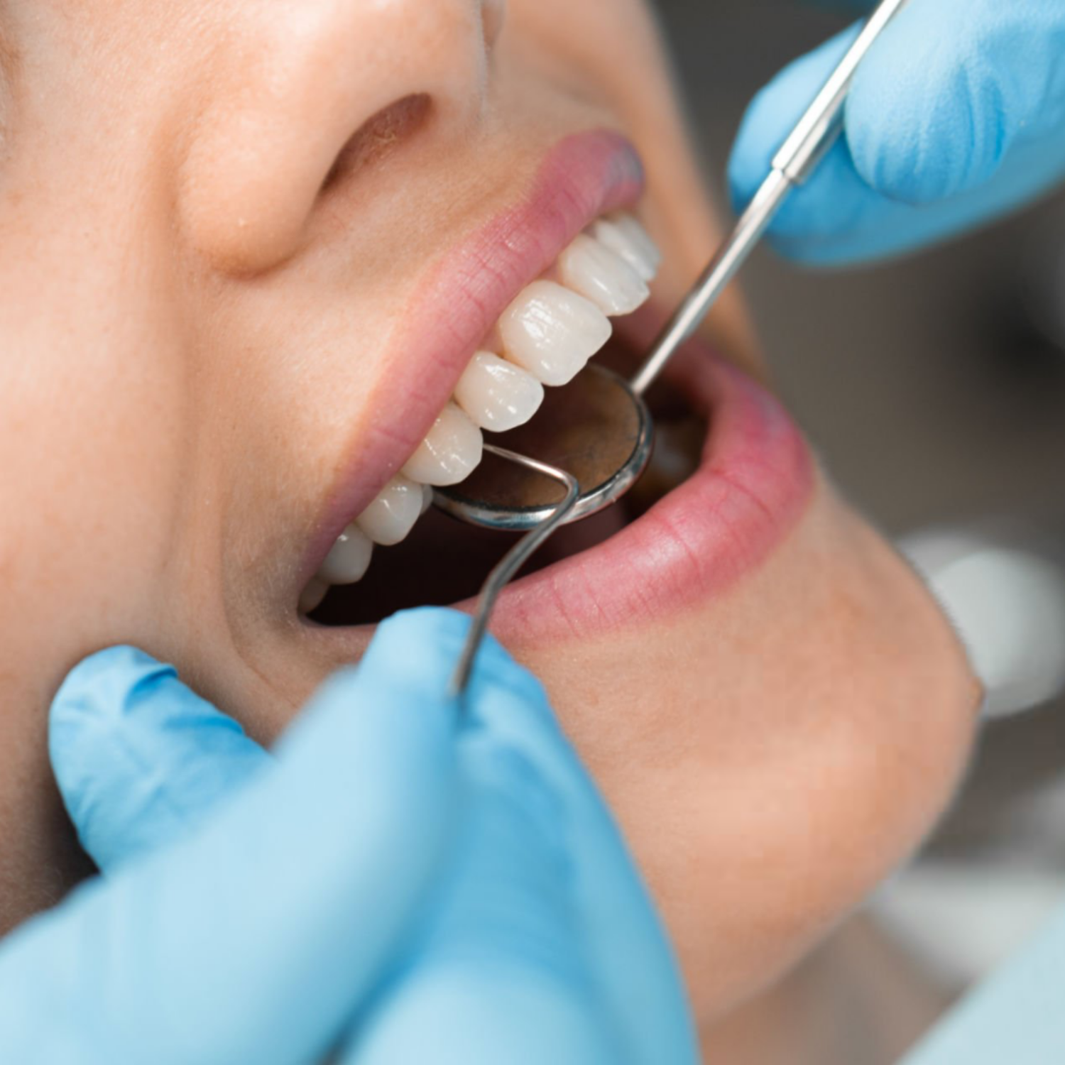 What Is a Hygiene Clean?