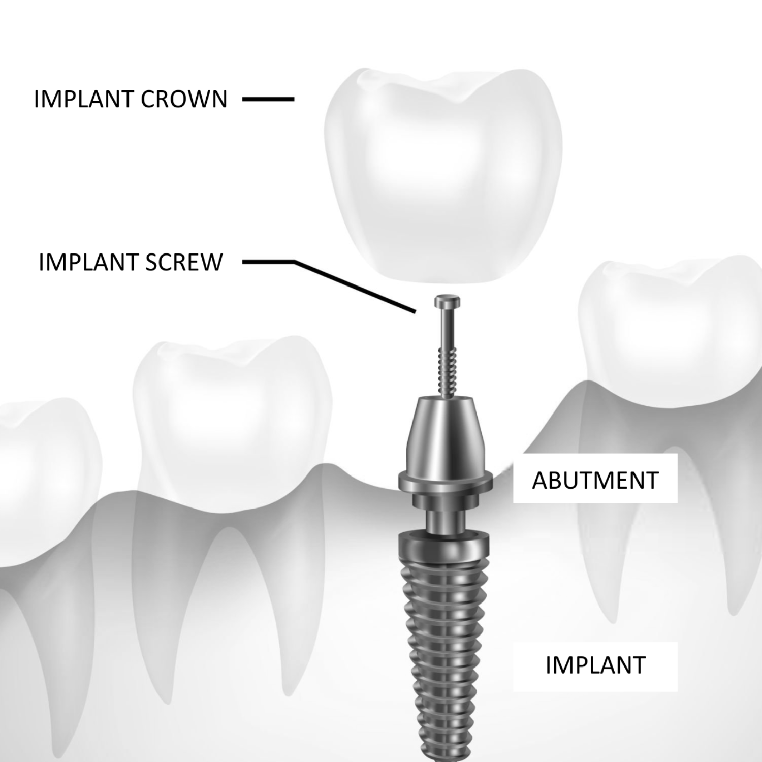 Initial Consultation and Assessment