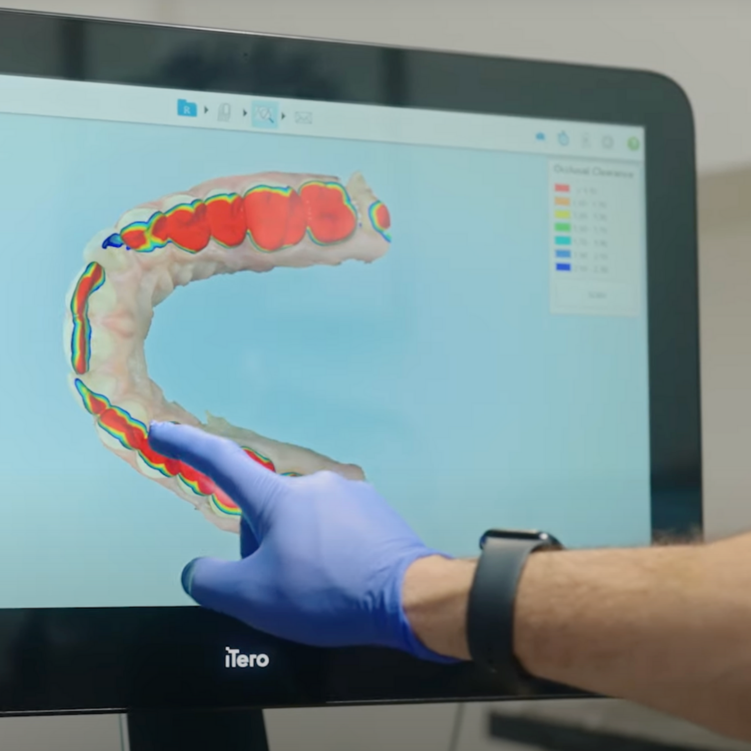 Digital Smile Design and Lab Collaboration