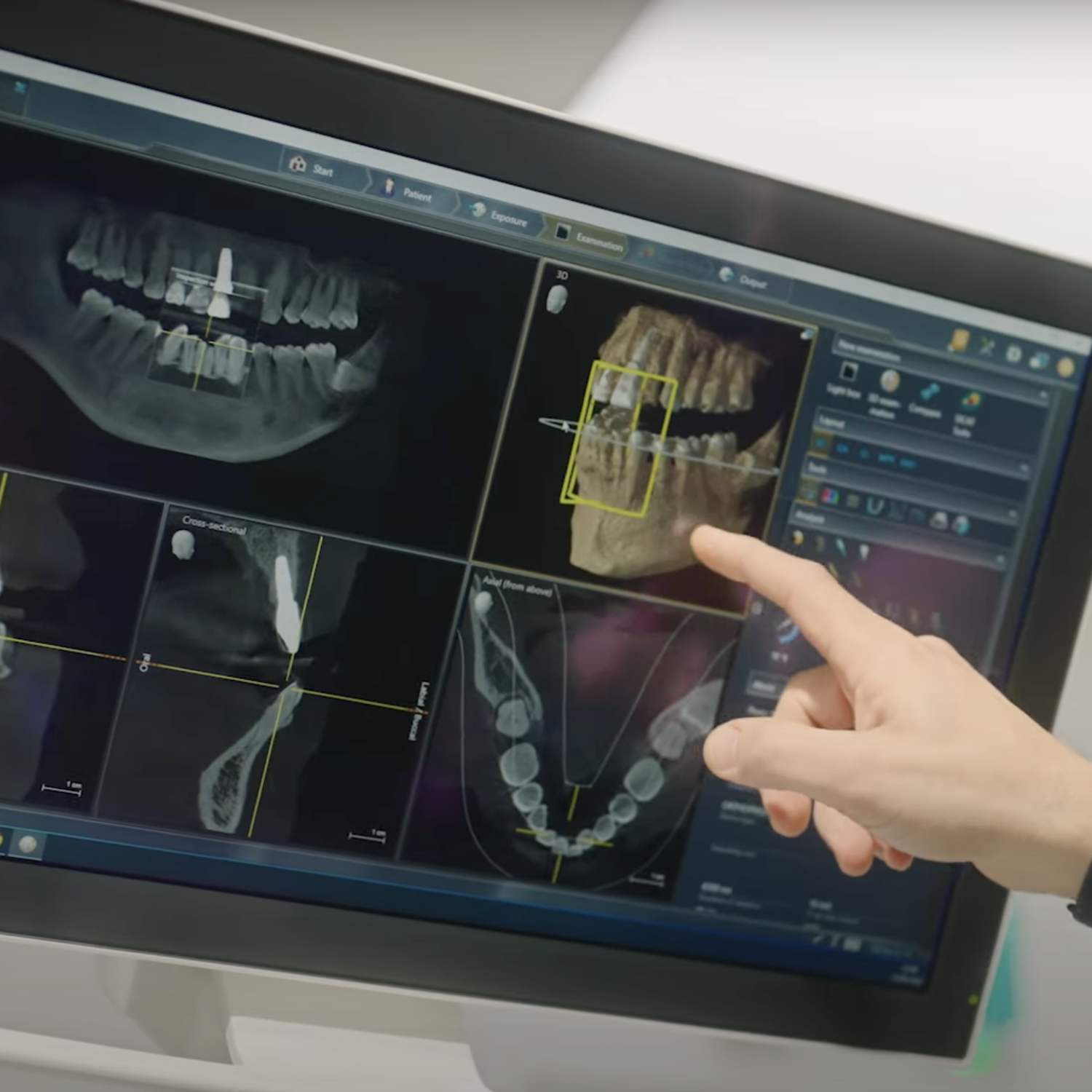 Why Meticulous Planning is Essential in Cosmetic Dentistry